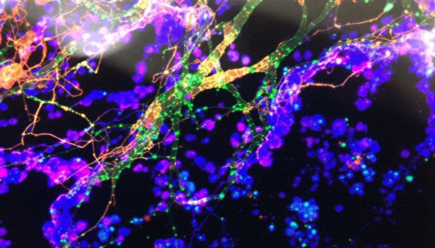 Microbiote et santé mentale comprendre l'impact de la flore intestinale sur le bien-être psychologique